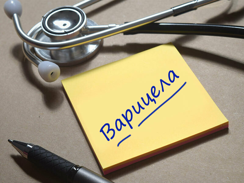 228 варненци се заразиха с варицела за седмица