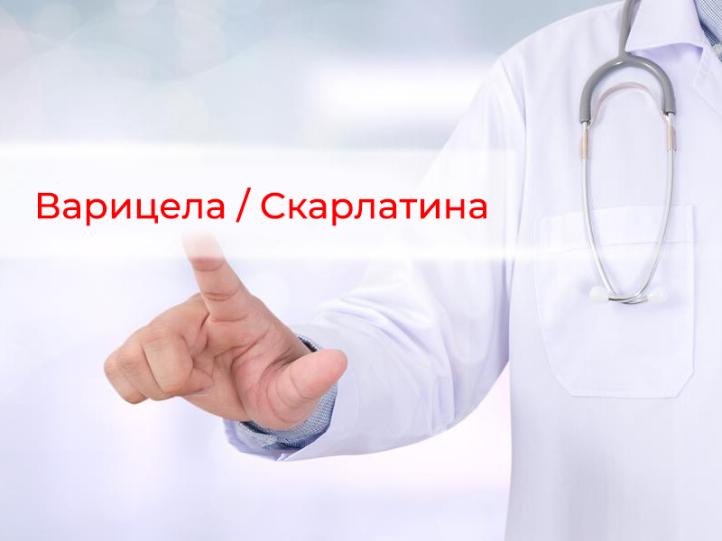 Близо 320 са заболелите от варицела и скарлатина във Варна за седмица